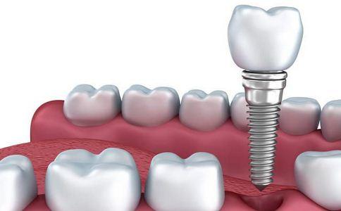 老年人可以做种植牙齿手术吗?